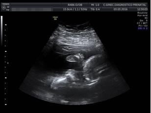 El milagro de la vida